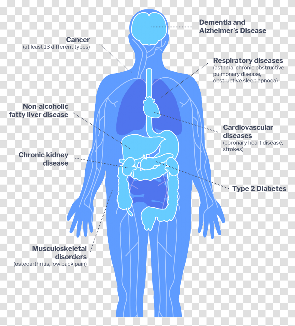 Impacts Of Diabetes On Health, Diagram, Plot, Person, Human Transparent Png