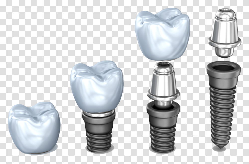 Implant Pieces Dental Implant Dentist Northborough Implante Dental De Titanio, Light, Lightbulb Transparent Png