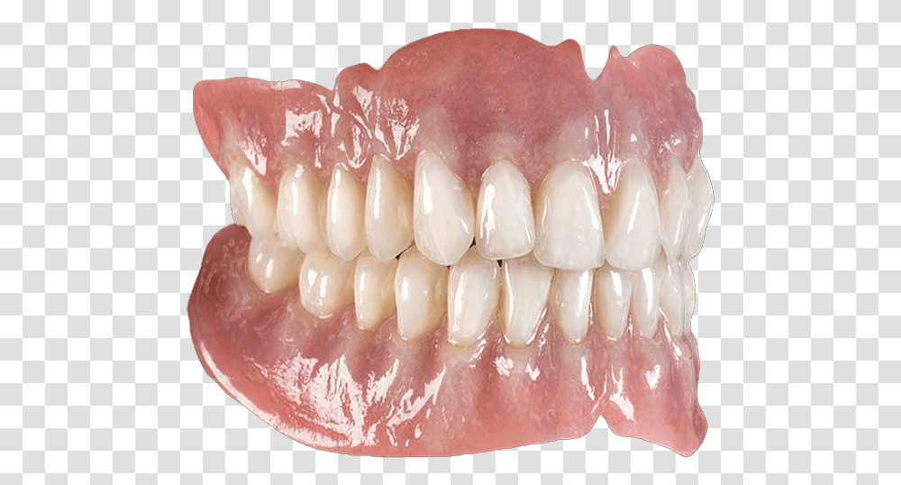 Implant Supported Dentures Los Angeles Dentures, Jaw, Teeth, Mouth Transparent Png