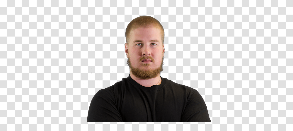 Incon Hair Loss, Face, Person, Human, Beard Transparent Png