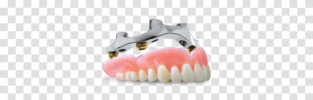 Index Of Overdenture, Jaw, Teeth, Mouth, Lip Transparent Png