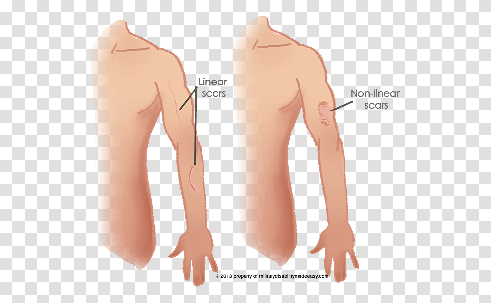 Index Of Scars, Plot, Arm, Back, Torso Transparent Png