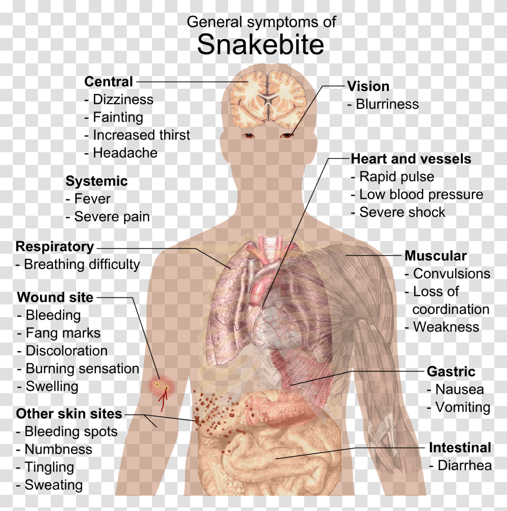 Infectious Mononucleosis, Apparel, Sleeve, Person Transparent Png