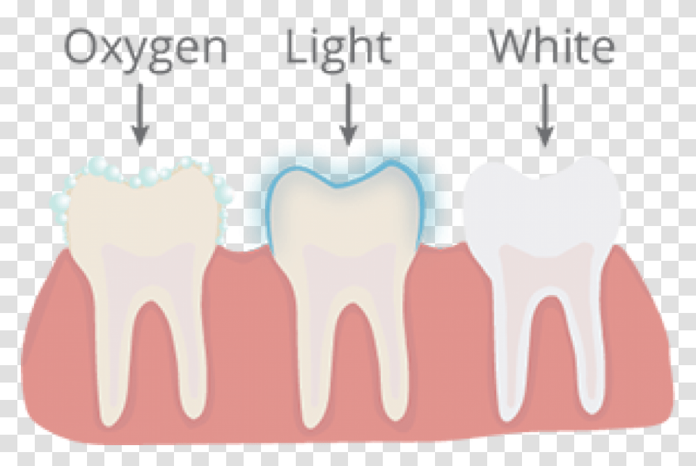 Inlay Onlay Crown, Teeth, Mouth, Lip, Nature Transparent Png