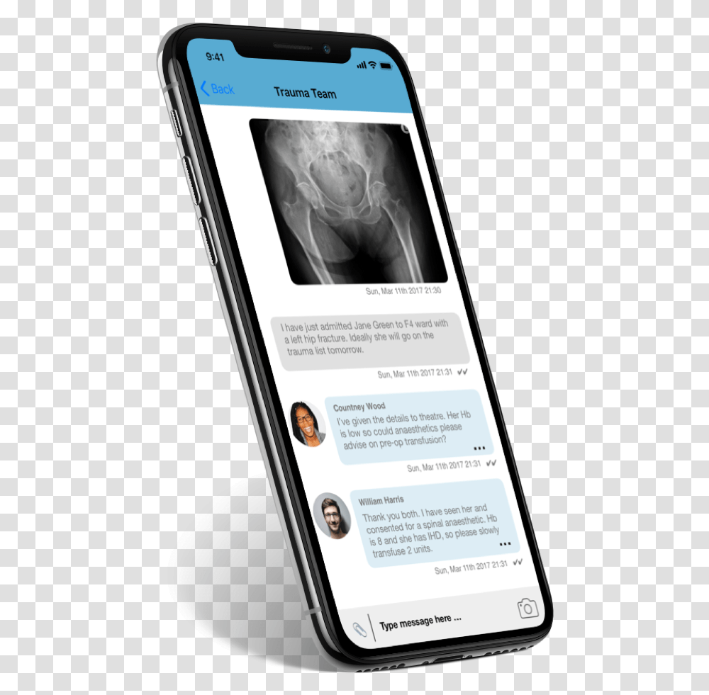 Iphone X Trauma Angled, Mobile Phone, Electronics, Cell Phone, Person Transparent Png