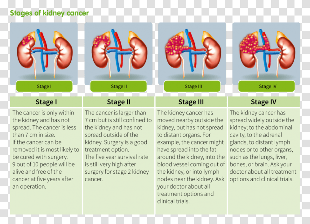 Kidney Tumor Stages, Label, Plot, Diagram Transparent Png
