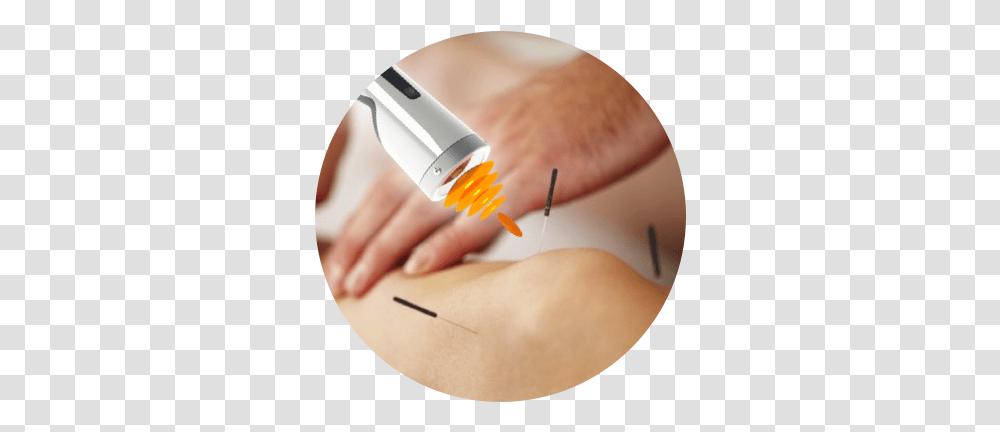 Knee Pain Treatment Nyc Injury & Rehab Hypodermic Needle, Person, Human, Injection, Arm Transparent Png