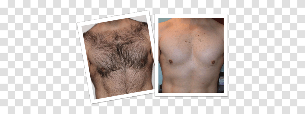 Laser Hair Removal Men Chest Hair Removal Spray, Collage, Poster, Advertisement, Person Transparent Png