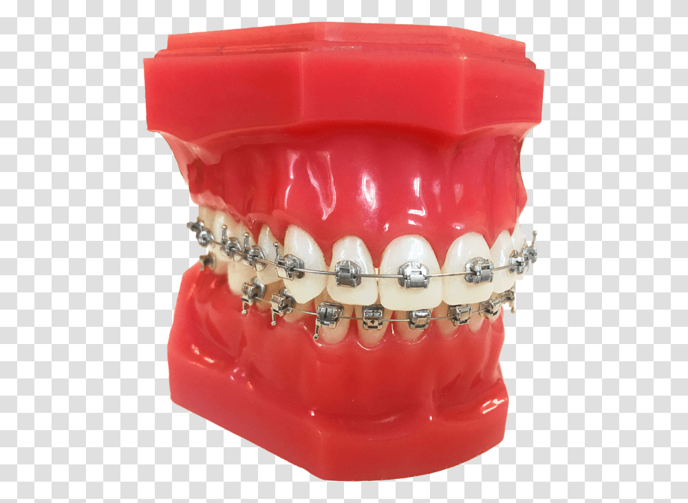 Le Genius Metal Plastic, Jaw, Teeth, Mouth, Lip Transparent Png