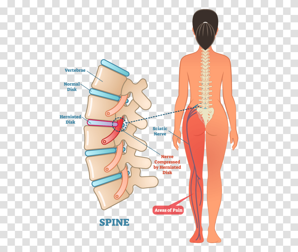 Left Side Sciatic Nerve Pain, Person, Human, Plot, Diagram Transparent Png