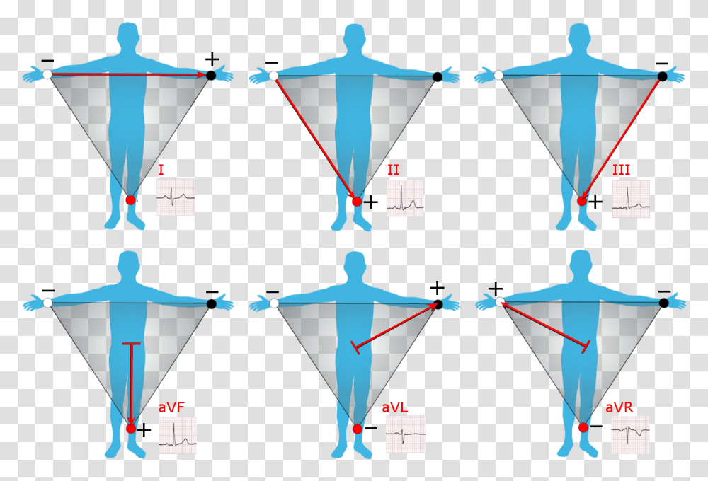 Limb Leads, Face, Pattern, Diagram, Plot Transparent Png