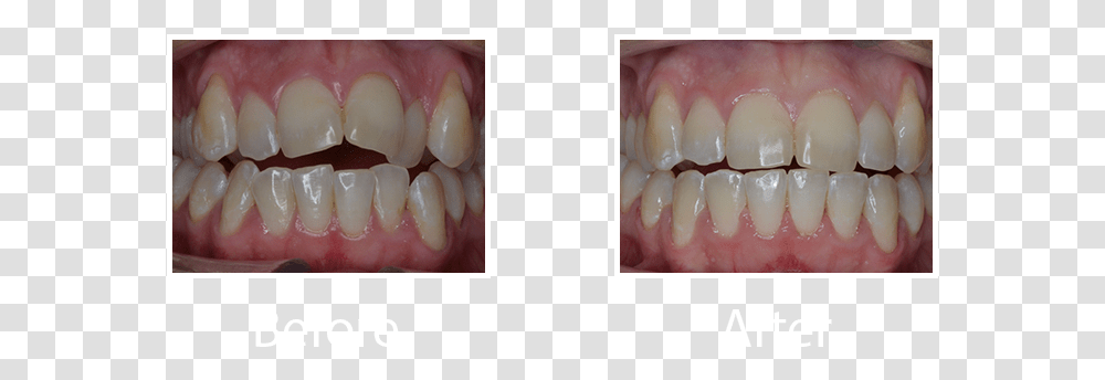 Macro Photography, Jaw, Teeth, Mouth, Lip Transparent Png