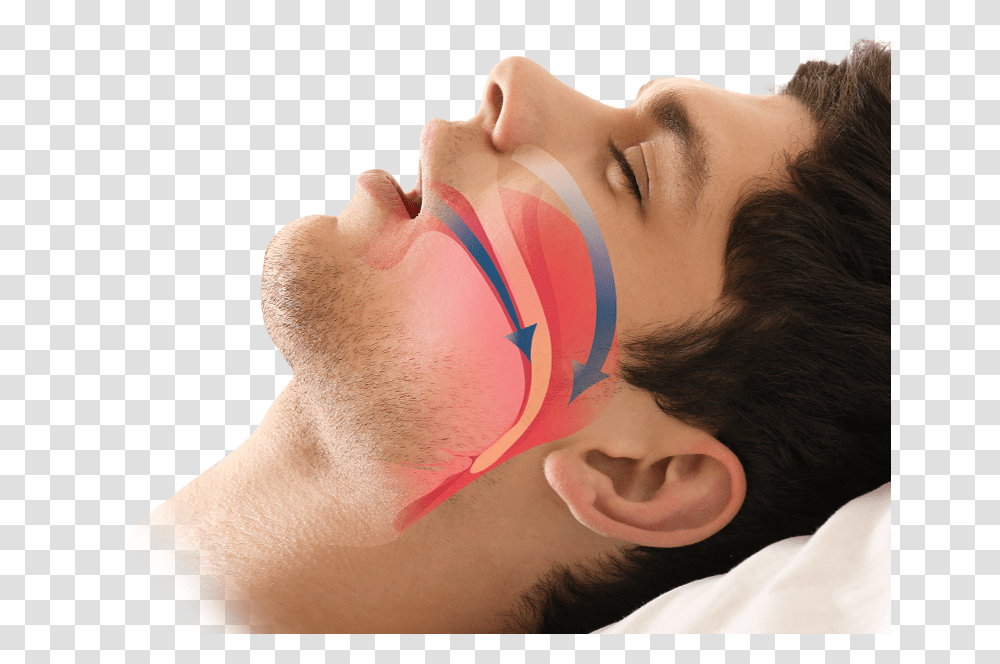 Man Sleeping Surgery Sleep Apnea, Face, Person, Skin, Mouth Transparent Png
