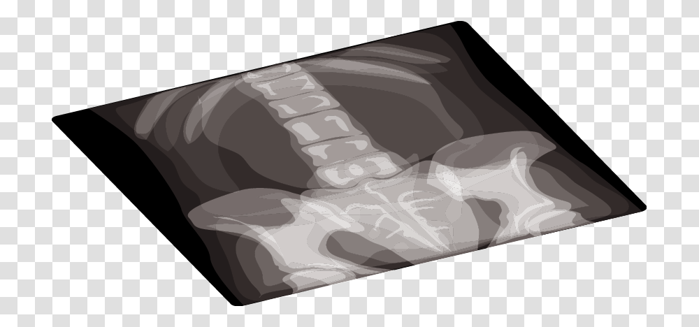 Medical Equipment Clipart Radiology, Rug, Teeth, Mouth Transparent Png