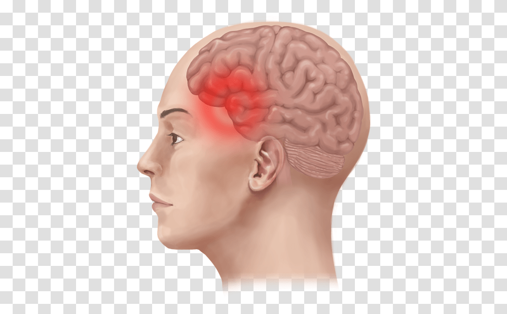 Migraine Pain In Head, Skin, Hair, Face, Person Transparent Png