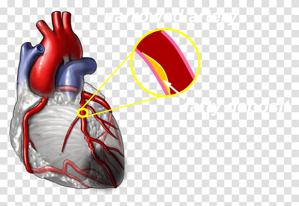 Moderate Blocked Heart Arteries, Outdoors, Nature Transparent Png