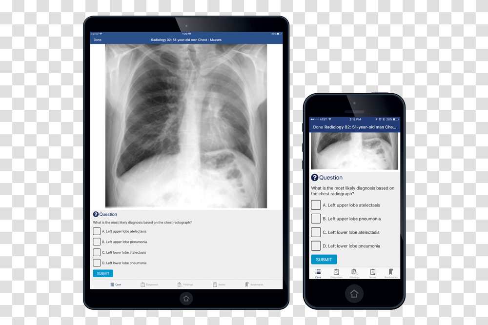 Module Title X Ray, Mobile Phone, Electronics, Cell Phone, Monitor Transparent Png