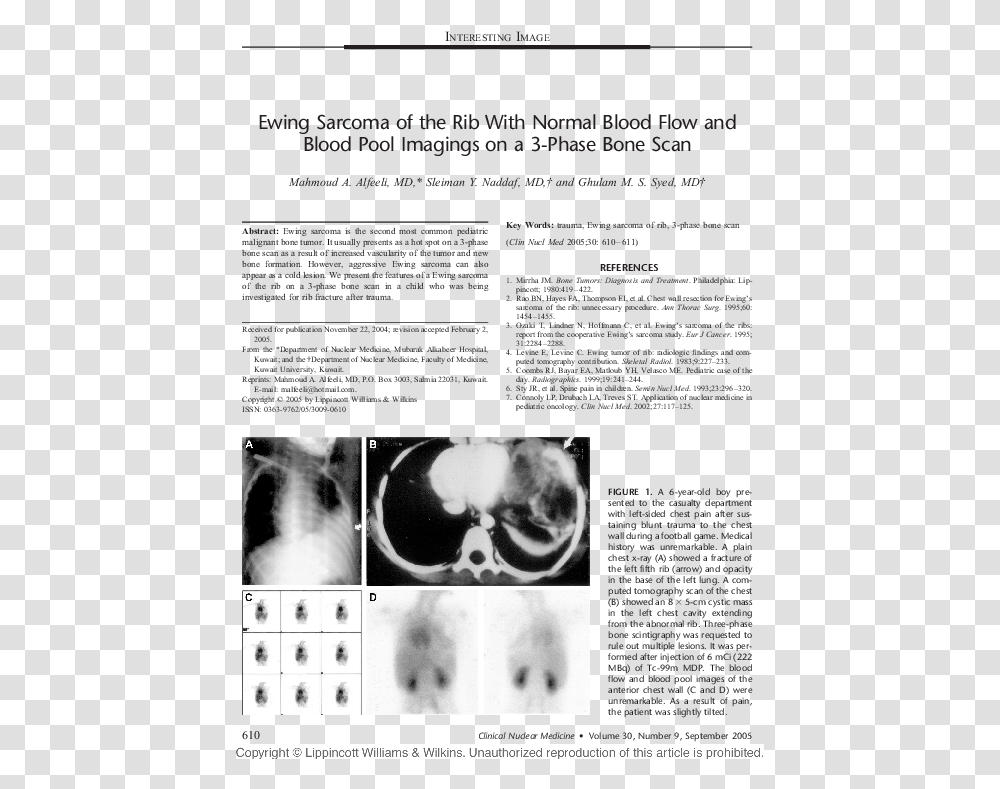 Monochrome, X-Ray, Medical Imaging X-Ray Film, Ct Scan, Cat Transparent Png