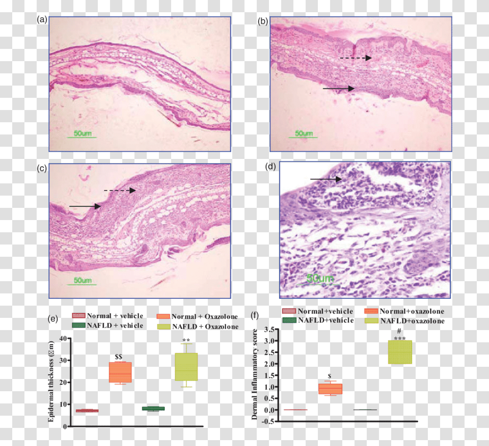 Mouse Ear Inflammation Histo, Collage, Poster, Advertisement, Plot Transparent Png