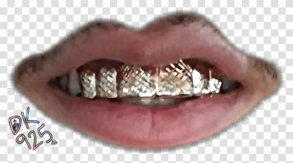 My Actual Gold Teeth Mouth, Lip, Person, Human, Ring Transparent Png
