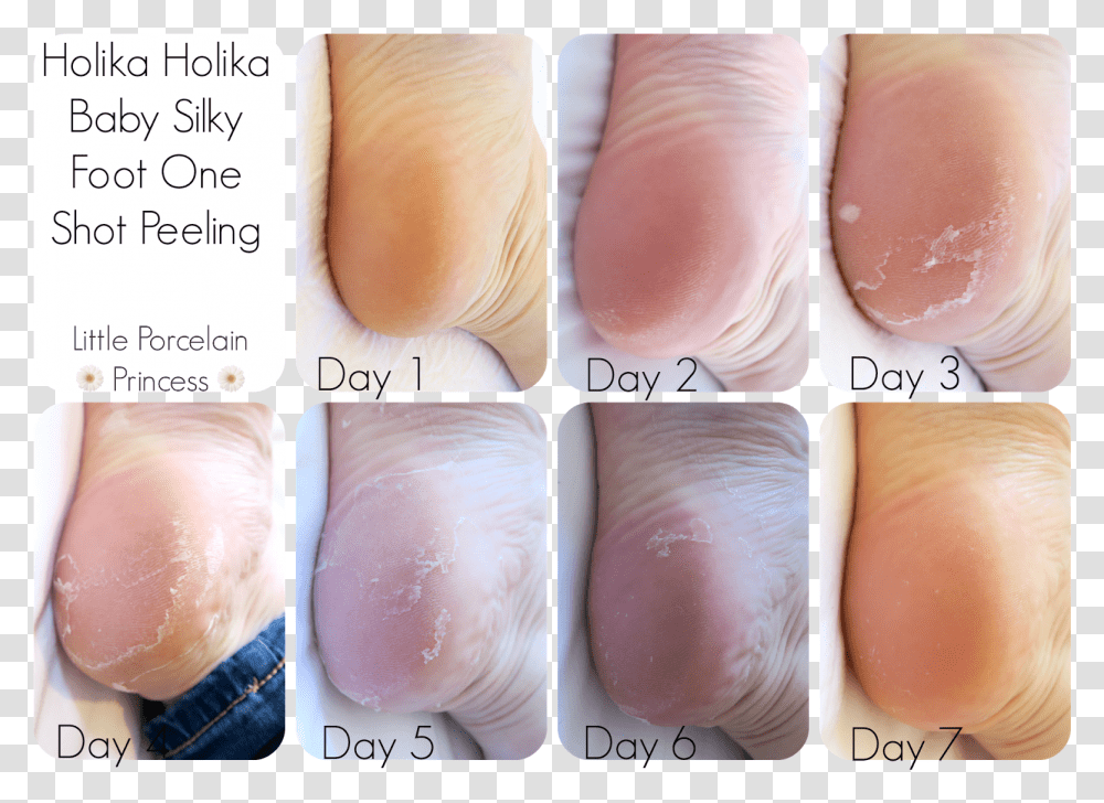 My Feet Did Peel Lightly For A Couple Of Days After Skin Republic Foot Peel Review, Heel, Person, Human, Nail Transparent Png