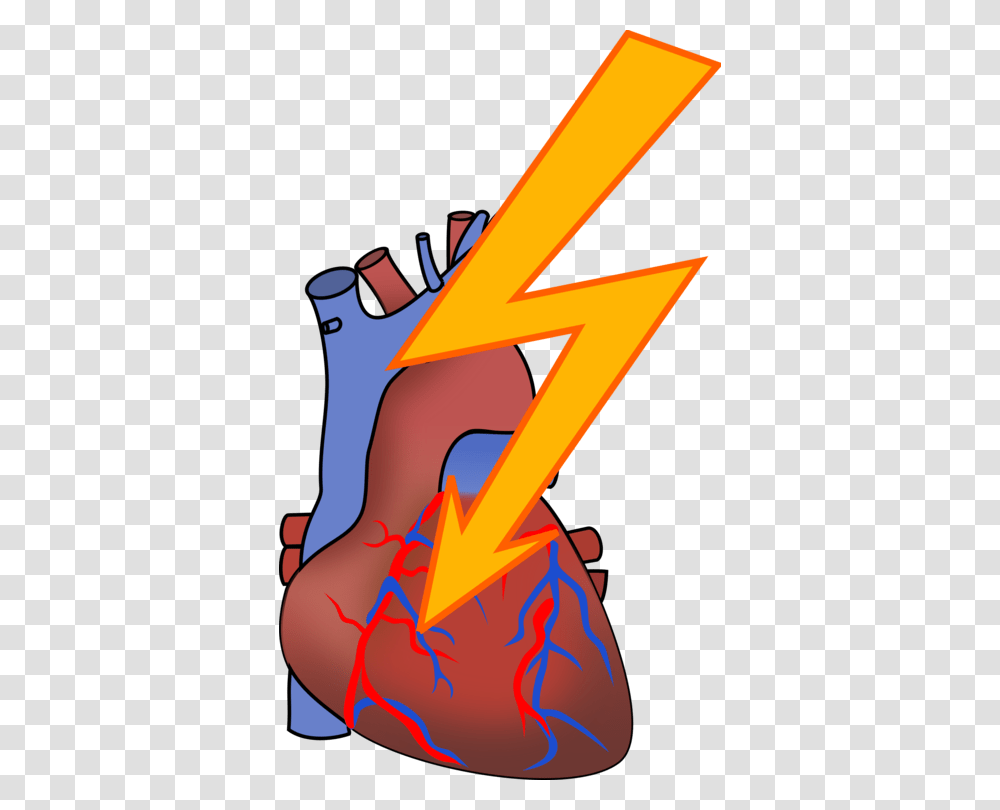 Myocardial Infarction Heart Arrhythmia Cardiovascular Disease Free, Number, Alphabet Transparent Png