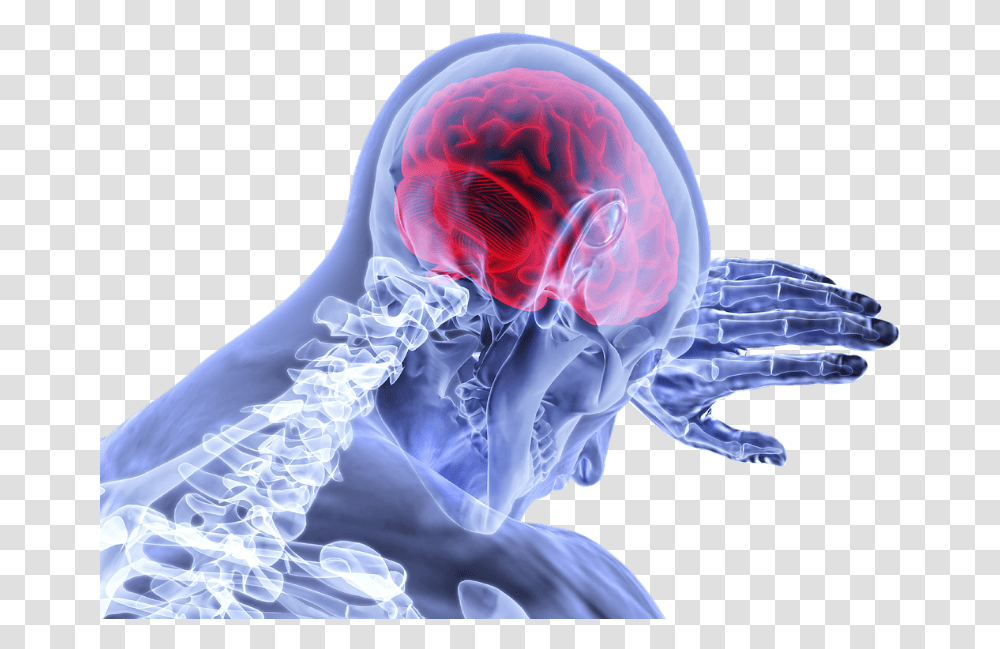 Neurology, X-Ray, Medical Imaging X-Ray Film, Ct Scan, Person Transparent Png