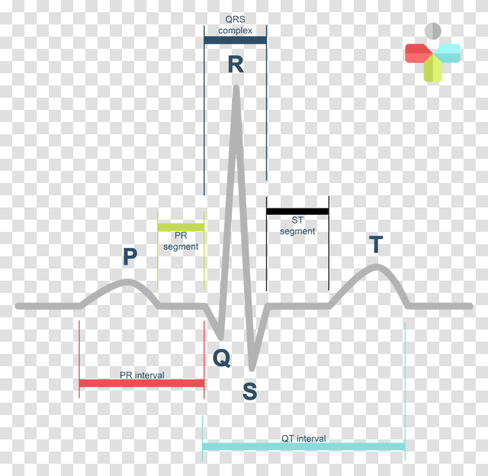 Normal Sinus Rhythm Labeled, Plan, Plot, Diagram, Cross Transparent Png