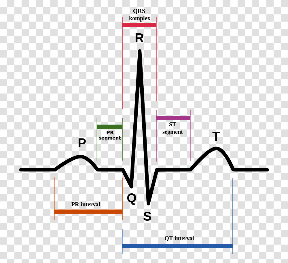 Normal Sinus Rhythm, Plot, Plan, Diagram, Cross Transparent Png