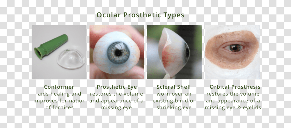 Ocular Prosthesis Types Diagram Types Of Eye Prosthesis, Person, Human, Invertebrate, Animal Transparent Png