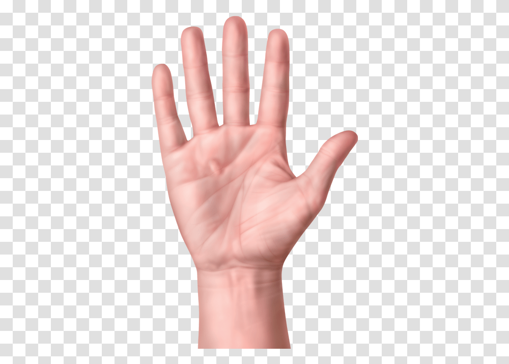 One Hand With Nodules Or Lump In Palm Of Hand Hand Dupuytren's Contracture, Wrist, Person, Human, Finger Transparent Png