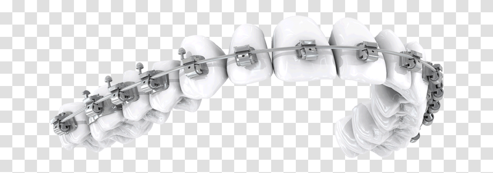 Orthodontic Brackets Image With Braces, Adapter, Plug Transparent Png