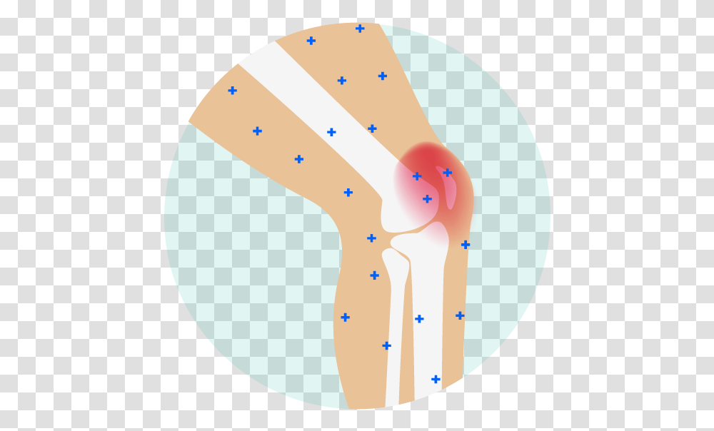 Pain Clipart Stiffness Knee Pain Cartoon, Hip, Plot, Diagram Transparent Png