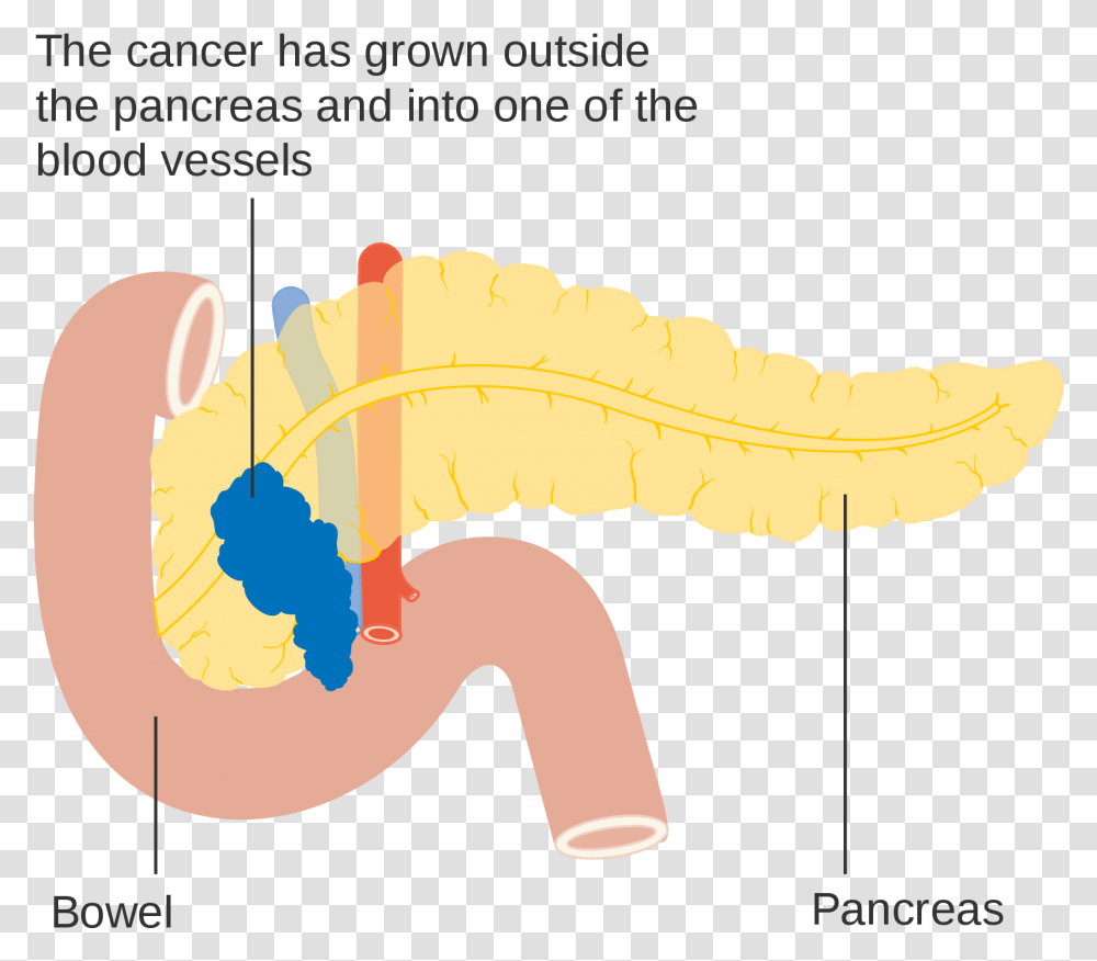 Pancreas Illustration, Teeth, Mouth, Lip, Animal Transparent Png