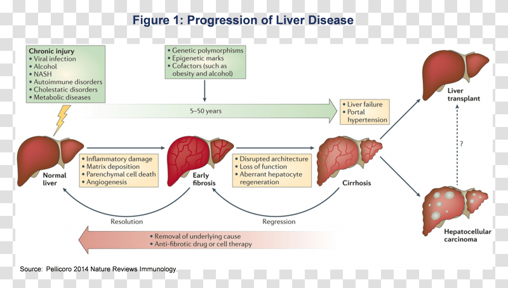 Pathophysiology Of Chronic Liver Cell Disease Transparent Png
