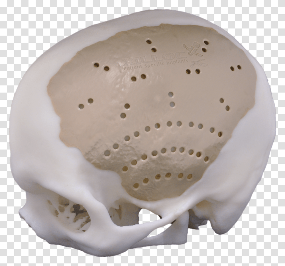 Peek Cranial Implant, Pottery, Egg, Food, Porcelain Transparent Png