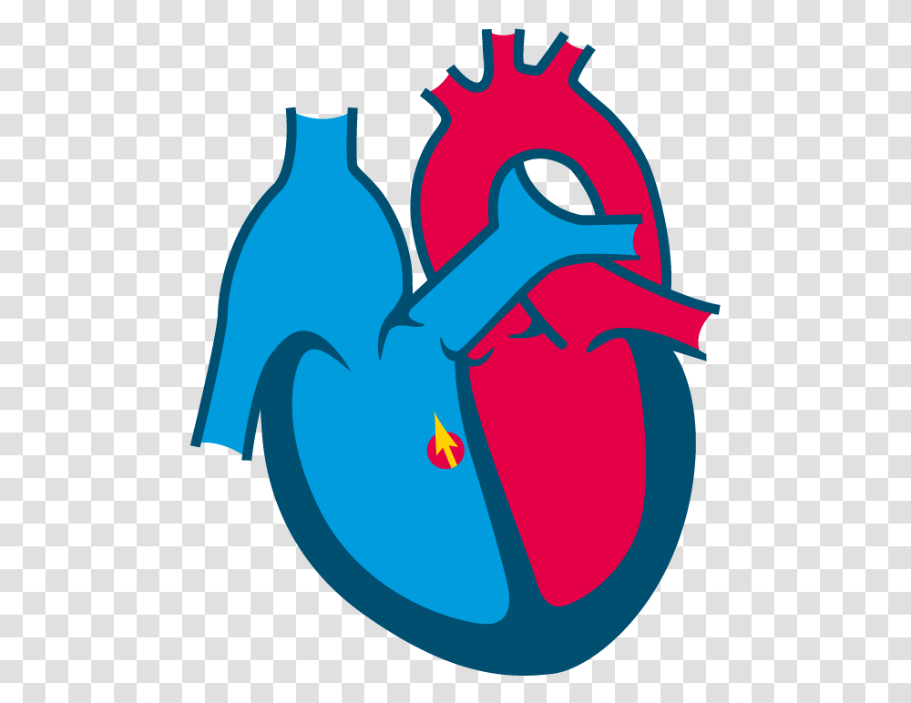 Perimembranous Vsd Congenital Heart Disease Clipart, Key, Hook Transparent Png