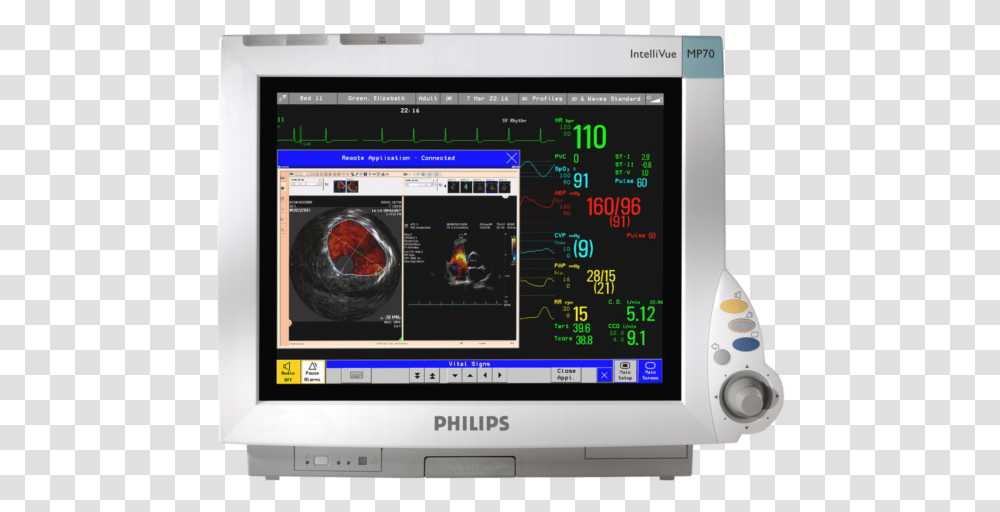 Philips Intellivue Mp70 Patient Monitor, Screen, Electronics, Display, LCD Screen Transparent Png