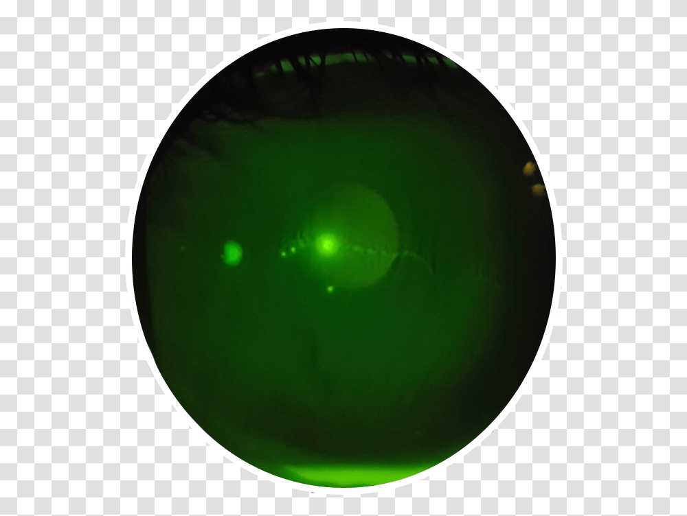 Photo Contest Green Lens Flare, Light, Sphere, Laser, Bowl Transparent Png