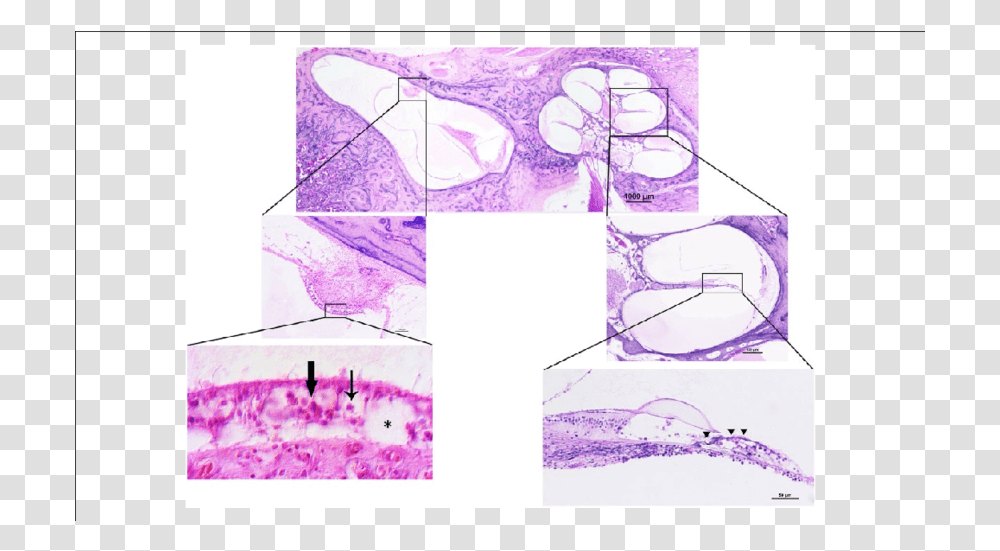 Photomicrograph Of The Left Temporal Bone Thin Arrow = Type Sketch, Purple, Art, Drawing, Plot Transparent Png