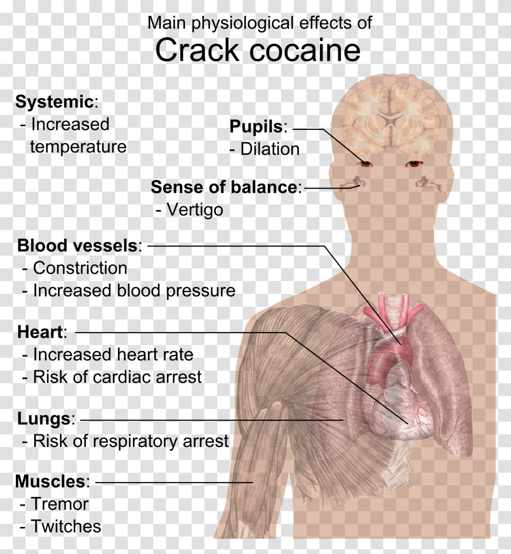 Physiological Effects Of Crack Cocaine Crack Does To Your Body, Neck, Person, Human, Head Transparent Png