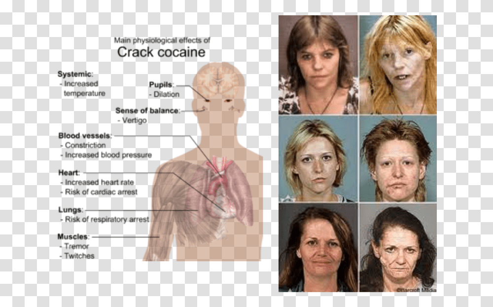 Picture Effects Of Crack Cocaine, Person, Head, Face, Hair Transparent Png