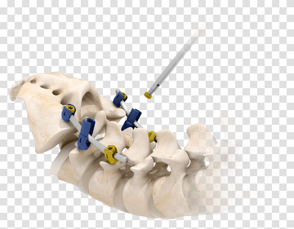 Picture Screw Degenerative Spine, Figurine, Snowman, Outdoors, Nature Transparent Png