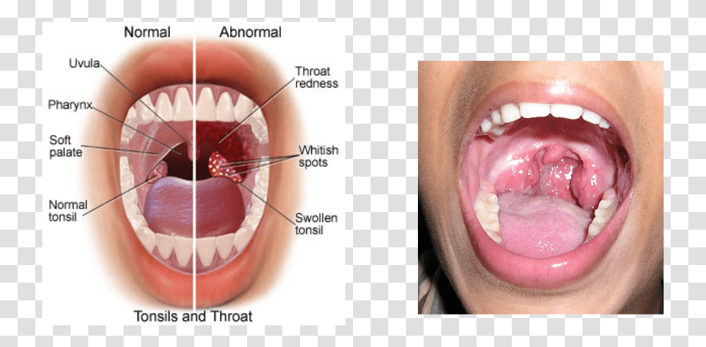 Picture, Teeth, Mouth, Lip, Jaw Transparent Png