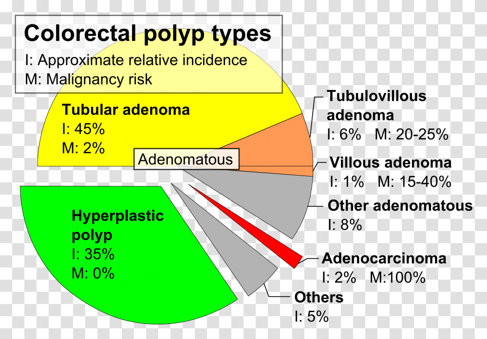 Pie Chart Of Colorectal Polyp Etiologies Colon Polyp Type, Plot, Diagram Transparent Png