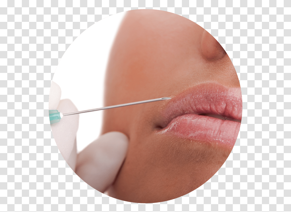 Pink Lips Injection Download Injection, Skin, Person, Human, Mouth Transparent Png