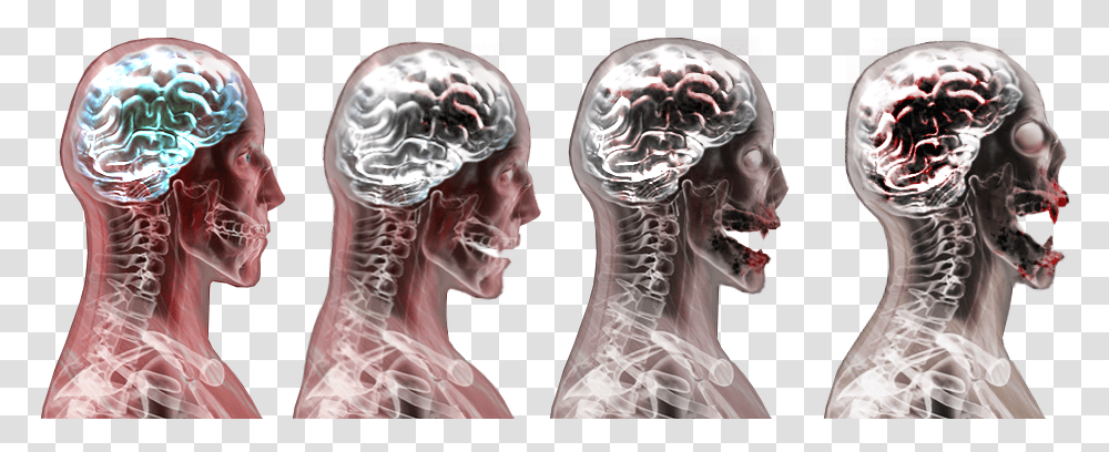 Plague Inc Shadow Plague, Person, Human, X-Ray, Medical Imaging X-Ray Film Transparent Png