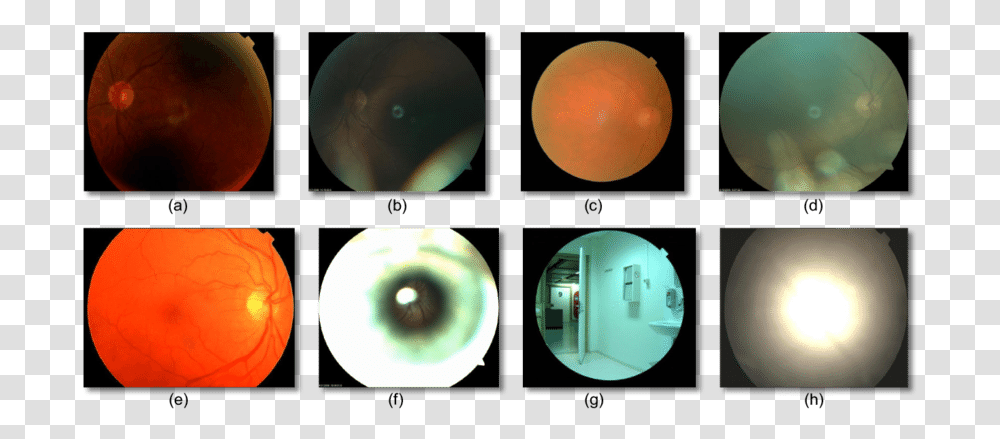 Poor Quality Of Fundus, Sphere, Mouse, Hardware, Computer Transparent Png