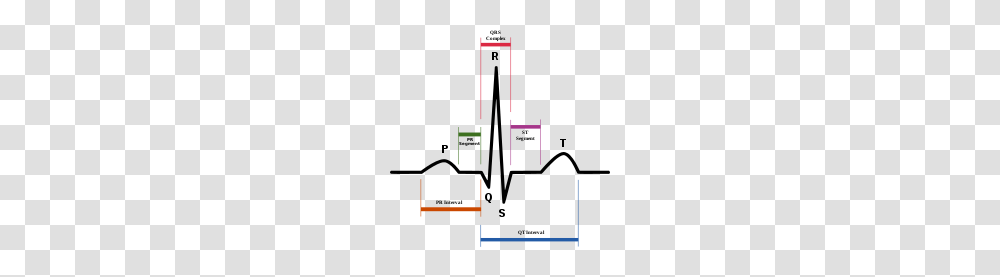 Pr Interval, Plot, Cross, Diagram Transparent Png