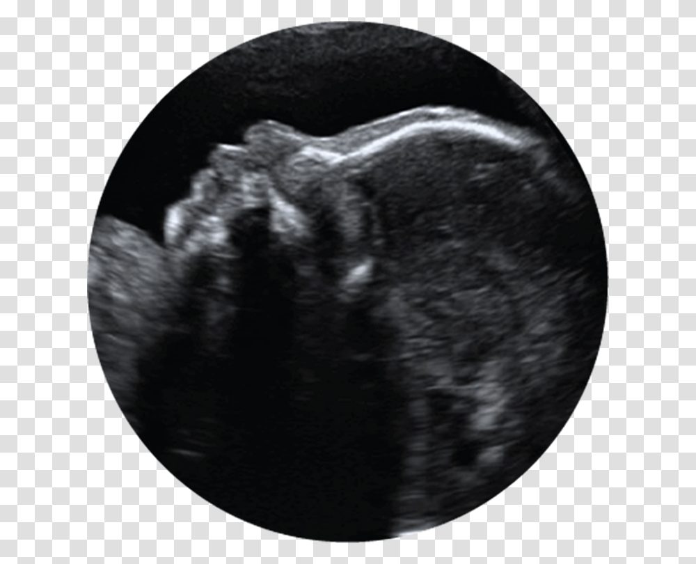 Prenatal Ultrasound Clipart, Cat, Pet, Mammal, Animal Transparent Png